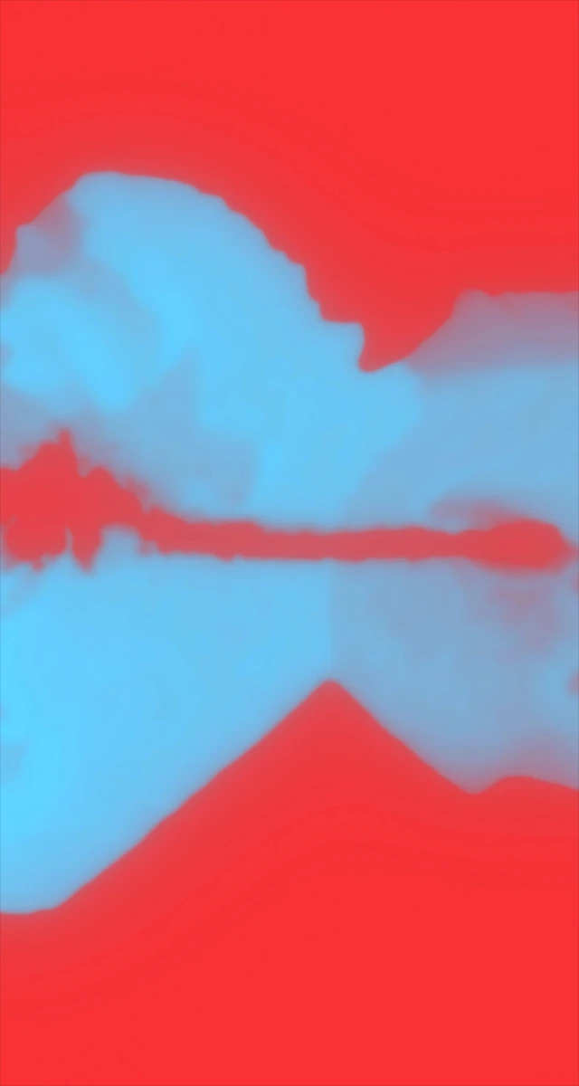 Ultrasound