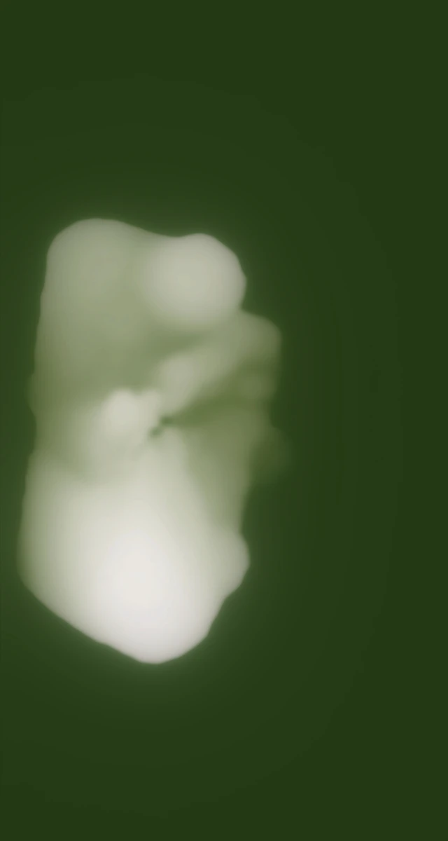 Ultrasound