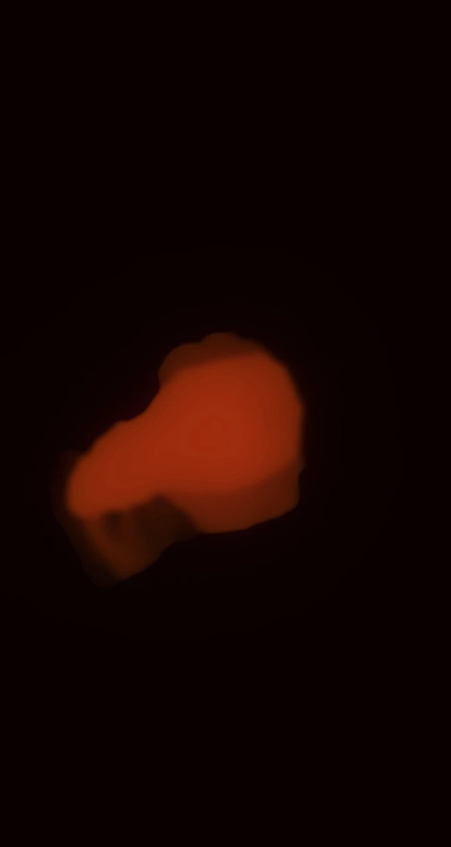 Ultrasound