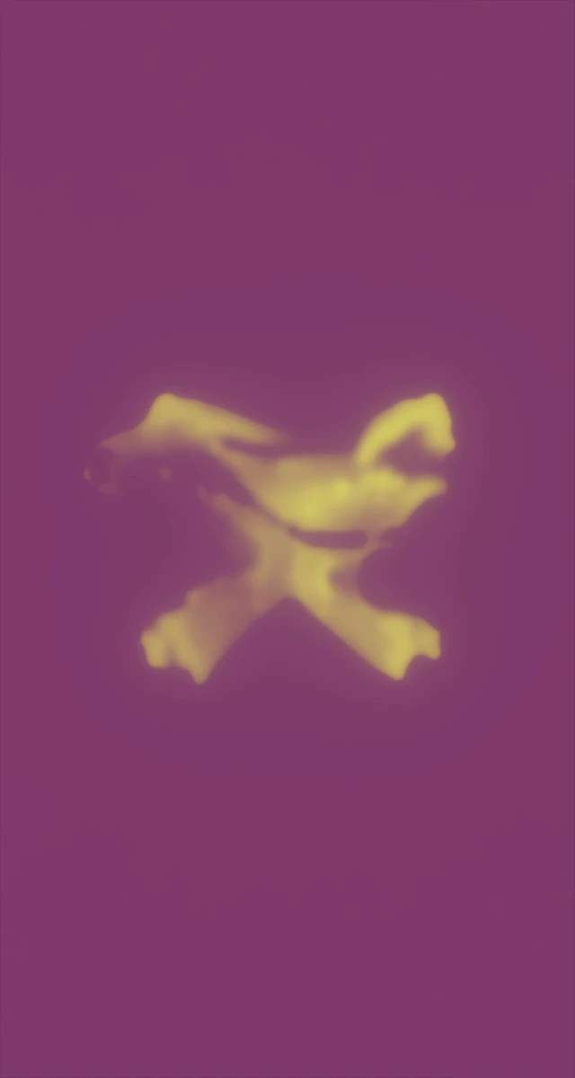 Ultrasound