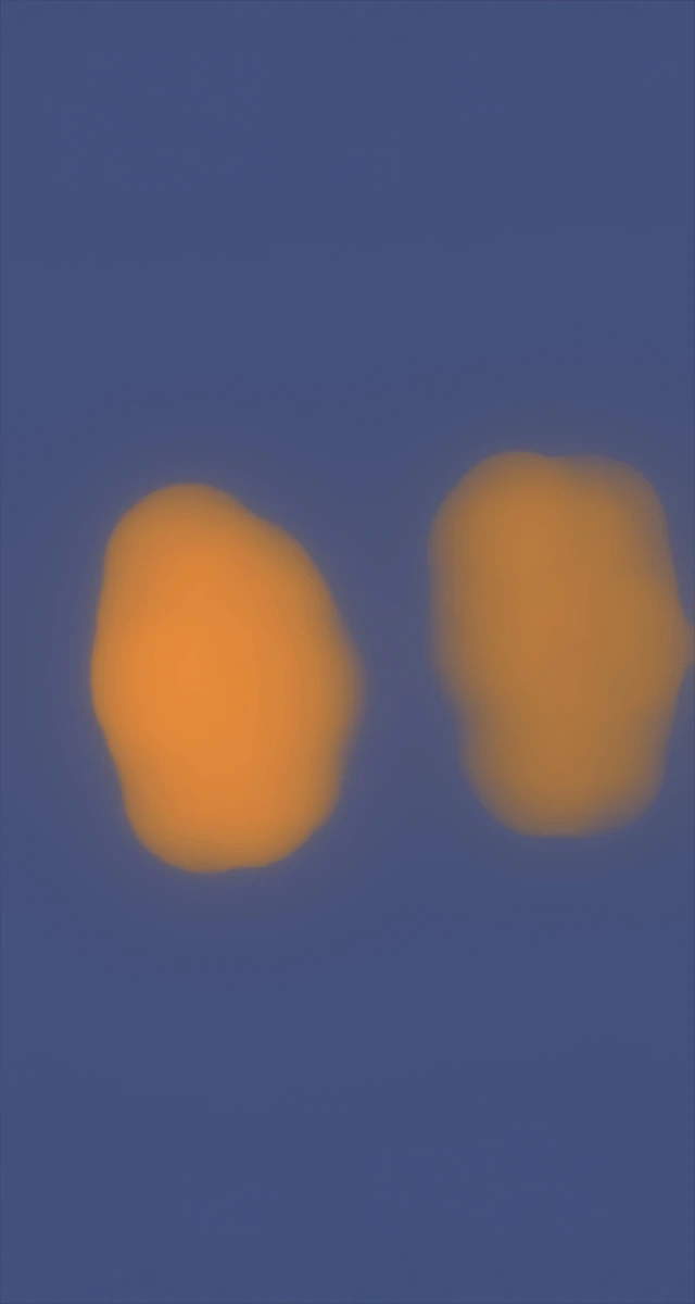 Ultrasound